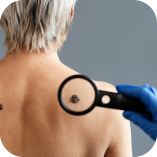 Onkodermatologie 